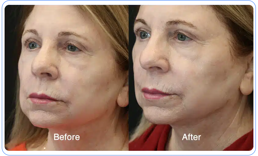 N1O1 nitric oxide for health and wellness