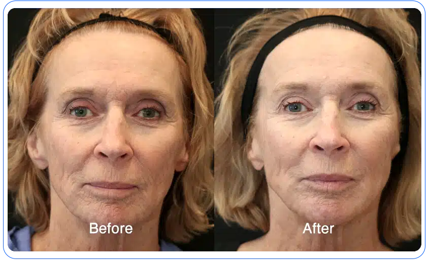 N1O1 nitric oxide for health and wellness