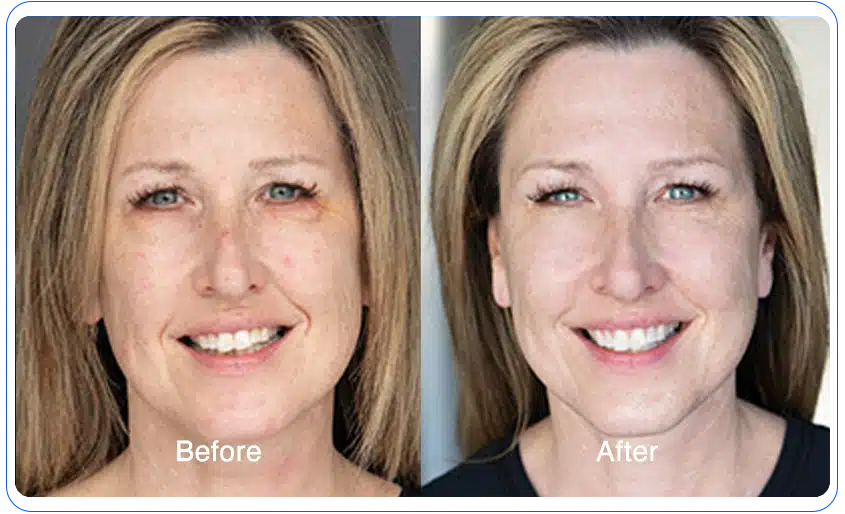 N1O1 nitric oxide for health and wellness