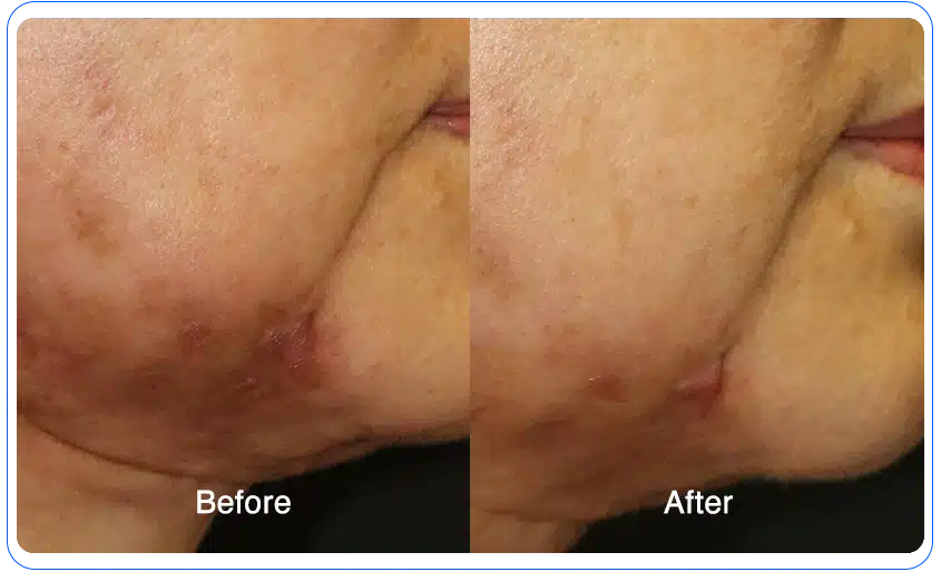 N1O1 nitric oxide for health and wellness