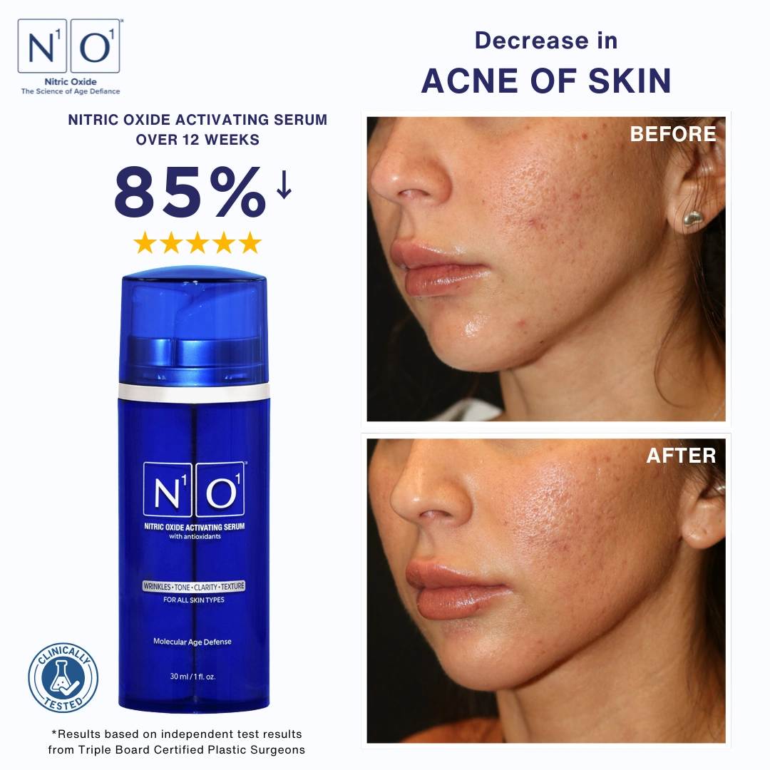 N1O1 nitric oxide skin health and rejuvenation