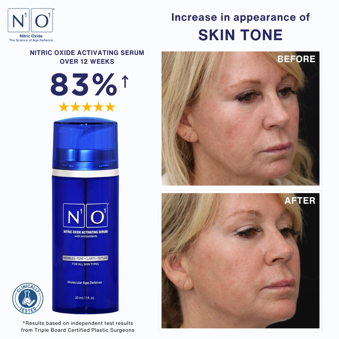 N1O1 nitric oxide skin health and rejuvenation