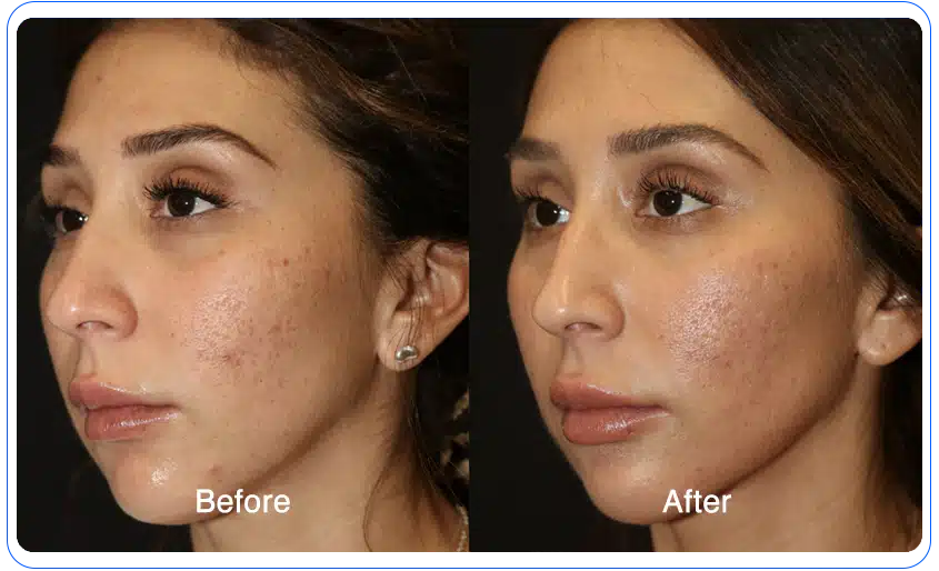 N1O1 nitric oxide for health and wellness