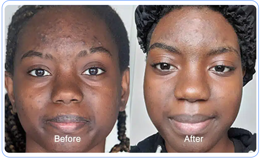 N1O1 nitric oxide for health and wellness