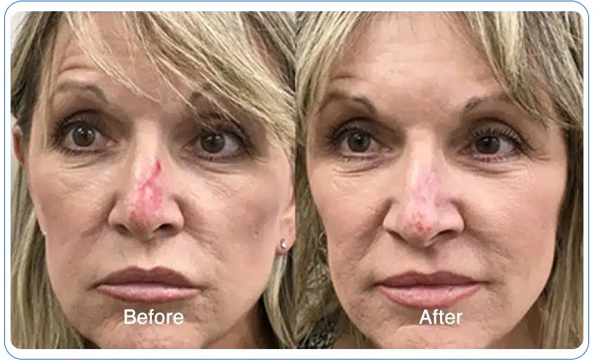 N1O1 nitric oxide for health and wellness