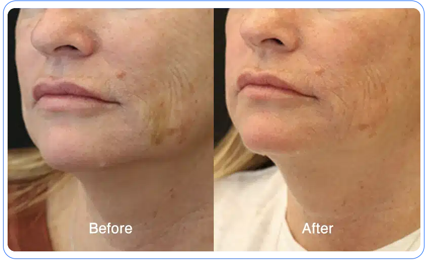 N1O1 nitric oxide for health and wellness