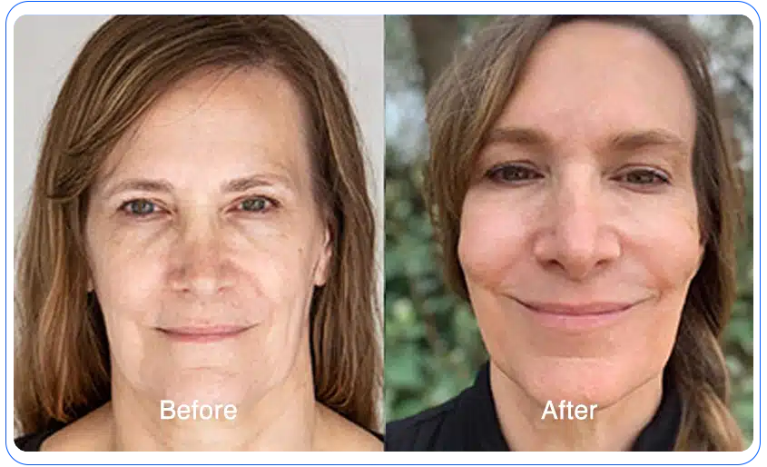 N1O1 nitric oxide for health and wellness