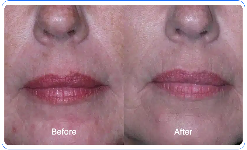 N1O1 nitric oxide for health and wellness