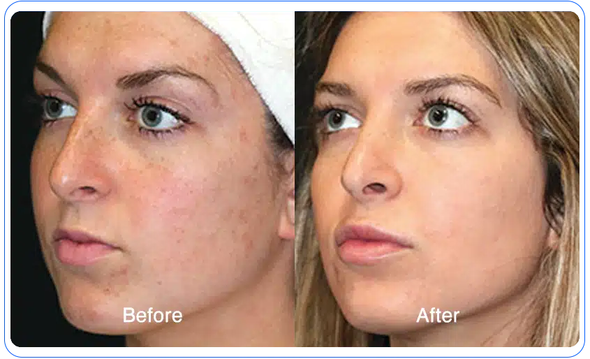 N1O1 nitric oxide for health and wellness