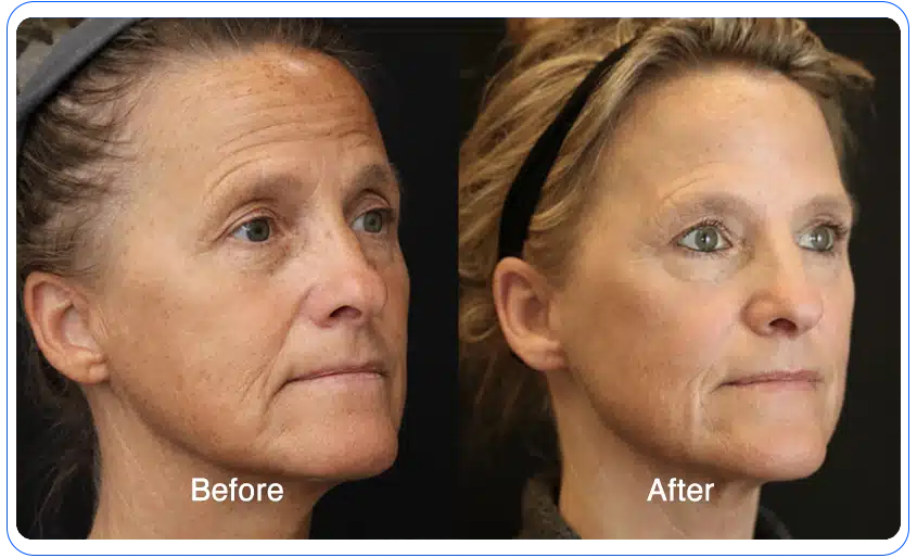 N1O1 nitric oxide for health and wellness