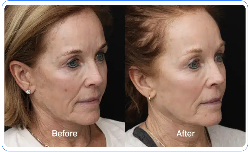 N1O1 nitric oxide for health and wellness