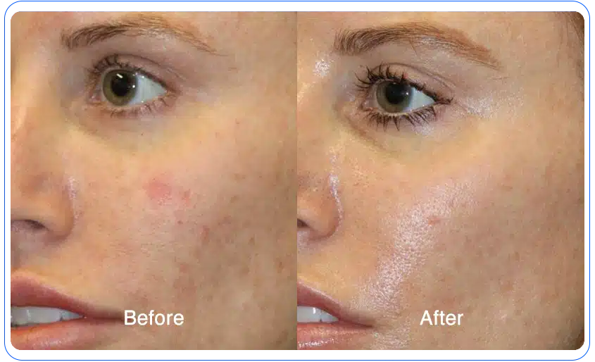 N1O1 nitric oxide for health and wellness