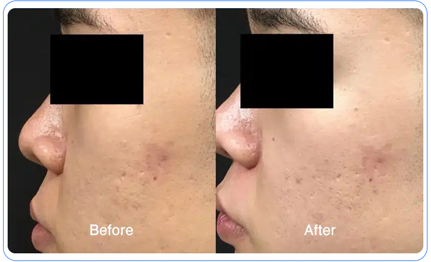 N1O1 nitric oxide for health and wellness